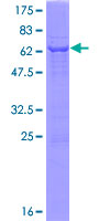 RNLS / Renalase Protein - 12.5% SDS-PAGE of human C10orf59 stained with Coomassie Blue