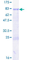 RNMTL1 Protein - 12.5% SDS-PAGE of human RNMTL1 stained with Coomassie Blue
