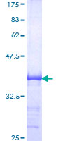 ROBO1 Protein - 12.5% SDS-PAGE Stained with Coomassie Blue.