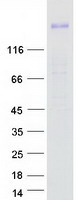 ROBO1 Protein - Purified recombinant protein ROBO1 was analyzed by SDS-PAGE gel and Coomassie Blue Staining