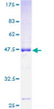 ROBO3 Protein - 12.5% SDS-PAGE of human ROBO3 stained with Coomassie Blue