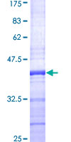 ROCK2 Protein - 12.5% SDS-PAGE Stained with Coomassie Blue.