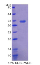 ROCK2 Protein - Recombinant Rho Associated Coiled Coil Containing Protein Kinase 2 By SDS-PAGE