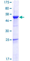 ROGDI Protein - 12.5% SDS-PAGE of human ROGDI stained with Coomassie Blue