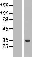 ROM1 Protein - Western validation with an anti-DDK antibody * L: Control HEK293 lysate R: Over-expression lysate