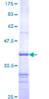 ROM1 Protein - 12.5% SDS-PAGE Stained with Coomassie Blue.