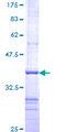 ROM1 Protein - 12.5% SDS-PAGE Stained with Coomassie Blue.