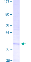 ROMO1 Protein - 12.5% SDS-PAGE of human ROMO1 stained with Coomassie Blue
