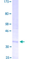 ROMO1 Protein - 12.5% SDS-PAGE of human ROMO1 stained with Coomassie Blue