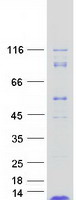 ROMO1 Protein - Purified recombinant protein ROMO1 was analyzed by SDS-PAGE gel and Coomassie Blue Staining