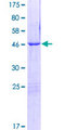 ROPN1L Protein - 12.5% SDS-PAGE of human ROPN1L stained with Coomassie Blue