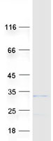 ROPN1L Protein - Purified recombinant protein ROPN1L was analyzed by SDS-PAGE gel and Coomassie Blue Staining