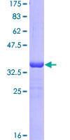 ROR1 Protein - 12.5% SDS-PAGE Stained with Coomassie Blue.