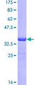 ROR1 Protein - 12.5% SDS-PAGE Stained with Coomassie Blue.