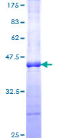ROR2 Protein - 12.5% SDS-PAGE Stained with Coomassie Blue.