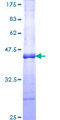 ROR2 Protein - 12.5% SDS-PAGE Stained with Coomassie Blue.