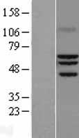 RORA / ROR Alpha Protein - Western validation with an anti-DDK antibody * L: Control HEK293 lysate R: Over-expression lysate