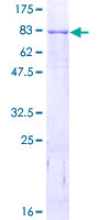 RORA / ROR Alpha Protein - 12.5% SDS-PAGE of human RORA stained with Coomassie Blue