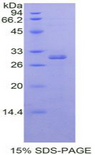 RORA / ROR Alpha Protein - Recombinant RAR Related Orphan Receptor Alpha By SDS-PAGE