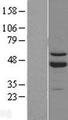 RORB / ROR Beta Protein - Western validation with an anti-DDK antibody * L: Control HEK293 lysate R: Over-expression lysate