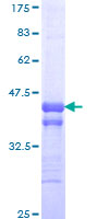 RORB / ROR Beta Protein - 12.5% SDS-PAGE Stained with Coomassie Blue.