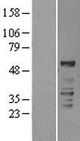 RORC / ROR Gamma Protein - Western validation with an anti-DDK antibody * L: Control HEK293 lysate R: Over-expression lysate
