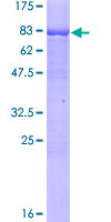 RORC / ROR Gamma Protein - 12.5% SDS-PAGE of human RORC stained with Coomassie Blue