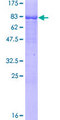 RORC / ROR Gamma Protein - 12.5% SDS-PAGE of human RORC stained with Coomassie Blue
