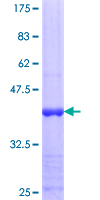 RORC / ROR Gamma Protein - 12.5% SDS-PAGE Stained with Coomassie Blue.