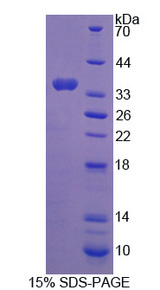 ROS1 / ROS Protein - Recombinant C-Ros Oncogene 1, Receptor Tyrosine Kinase By SDS-PAGE