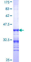 ROX / MNT Protein - 12.5% SDS-PAGE Stained with Coomassie Blue.