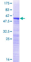 RP9 Protein - 12.5% SDS-PAGE of human RP9 stained with Coomassie Blue