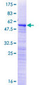 RP9 Protein - 12.5% SDS-PAGE of human RP9 stained with Coomassie Blue