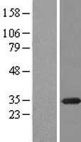 RPA2 / RFA2 / RPA34 Protein - Western validation with an anti-DDK antibody * L: Control HEK293 lysate R: Over-expression lysate