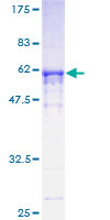 RPA2 / RFA2 / RPA34 Protein - 12.5% SDS-PAGE of human RPA2 stained with Coomassie Blue