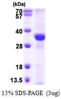 RPA2 / RFA2 / RPA34 Protein