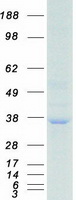 RPA2 / RFA2 / RPA34 Protein - Purified recombinant protein RPA2 was analyzed by SDS-PAGE gel and Coomassie Blue Staining