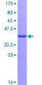 RPA3 Protein - 12.5% SDS-PAGE of human RPA3 stained with Coomassie Blue