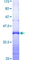 RPA3 Protein - 12.5% SDS-PAGE Stained with Coomassie Blue.