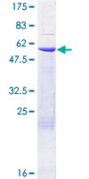 RPA4 Protein - 12.5% SDS-PAGE of human RPA4 stained with Coomassie Blue