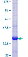 RPA4 Protein - 12.5% SDS-PAGE Stained with Coomassie Blue