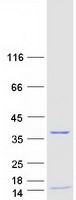 RPA4 Protein - Purified recombinant protein RPA4 was analyzed by SDS-PAGE gel and Coomassie Blue Staining
