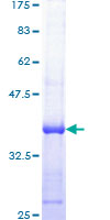 RPA70 / RPA1 Protein - 12.5% SDS-PAGE Stained with Coomassie Blue.