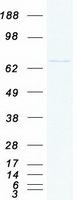 RPA70 / RPA1 Protein - Purified recombinant protein RPA1 was analyzed by SDS-PAGE gel and Coomassie Blue Staining