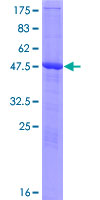 RPAIN Protein - 12.5% SDS-PAGE of human RPAIN stained with Coomassie Blue