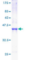 RPB16 / POLR2D Protein - 12.5% SDS-PAGE of human POLR2D stained with Coomassie Blue