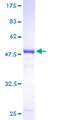 RPE Protein - 12.5% SDS-PAGE of human RPE stained with Coomassie Blue