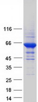 RPE65 Protein - Purified recombinant protein RPE65 was analyzed by SDS-PAGE gel and Coomassie Blue Staining