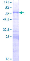 RPF2 / BXDC1 Protein - 12.5% SDS-PAGE of human BXDC1 stained with Coomassie Blue