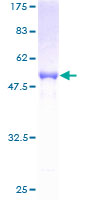 RPIA / RPI Protein - 12.5% SDS-PAGE of human RPIA stained with Coomassie Blue